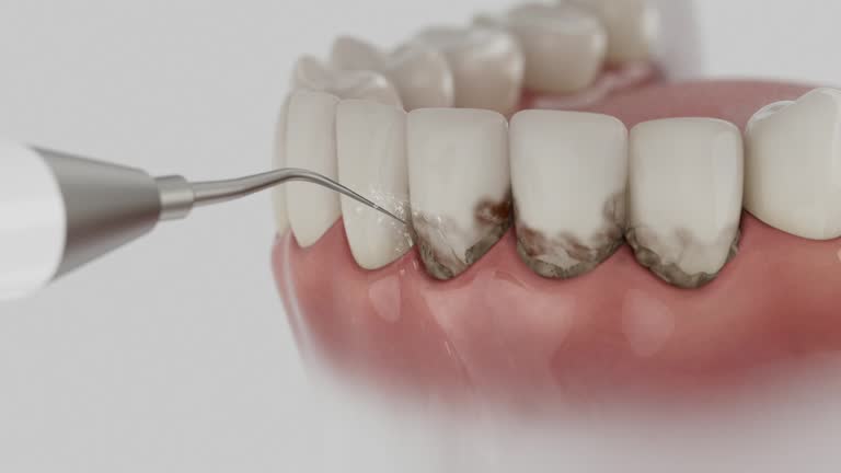 Trusted Dental Implants service in Chauvin, LA - Dentist Open Now
